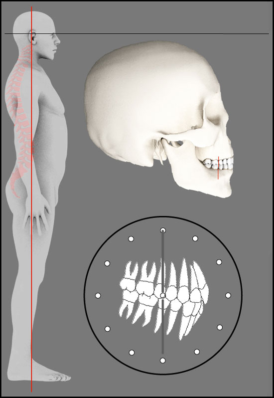 Darstellung der Angle Klasse 1