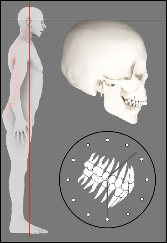 Darstellung der Angle Klasse 1-1