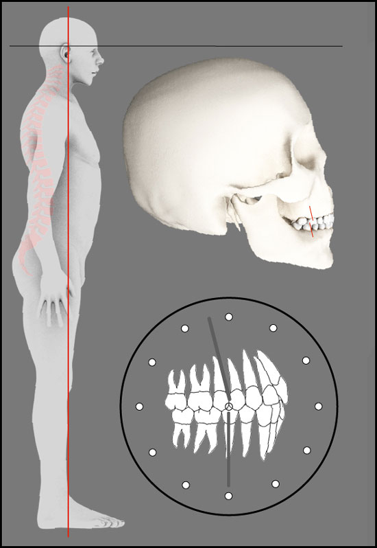 Darstellung der Angle Klasse 2-2