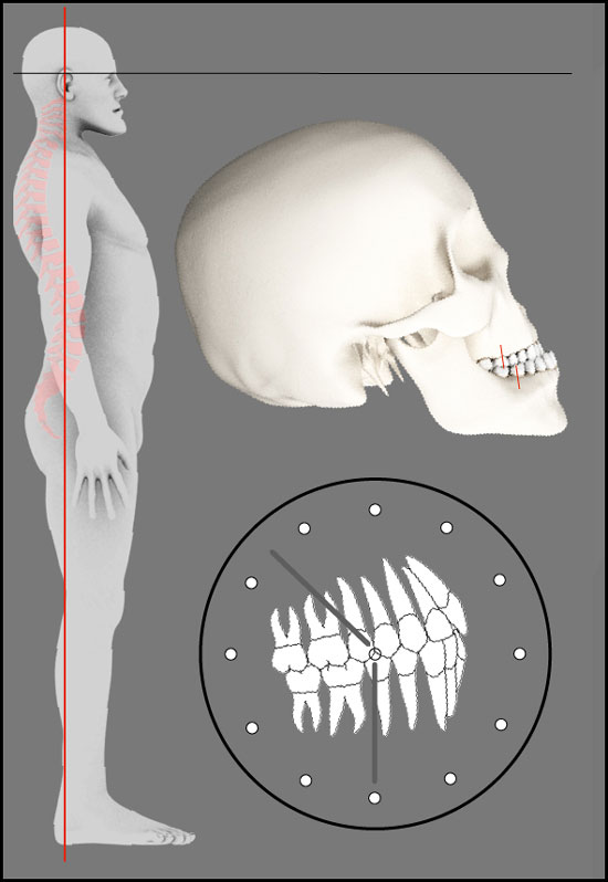 Darstellung der Angle Klasse 3