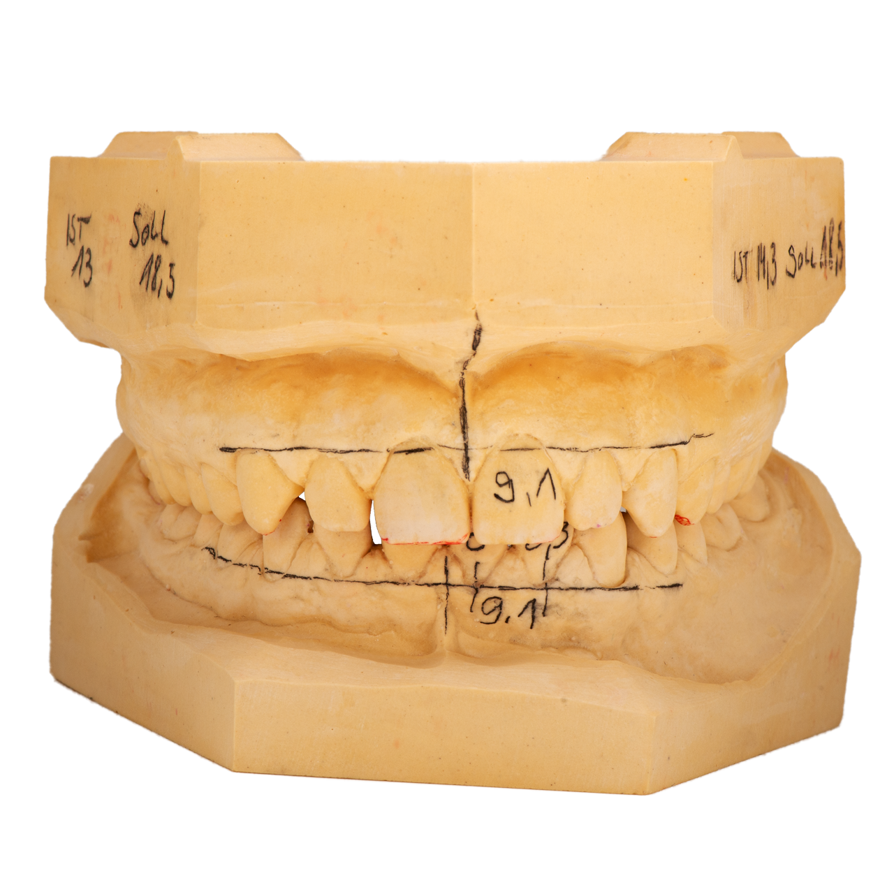 Modellanalyse nach Shimbash