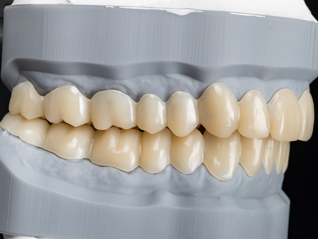 seitliche Ansicht der Schienen - rechte Seite
