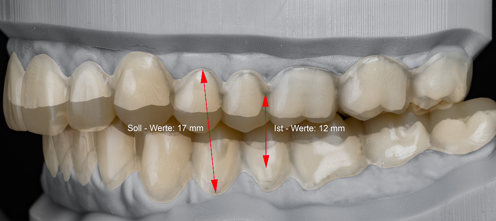 Darstellung der Höhe nach Shimbashi - Seitenzähne links