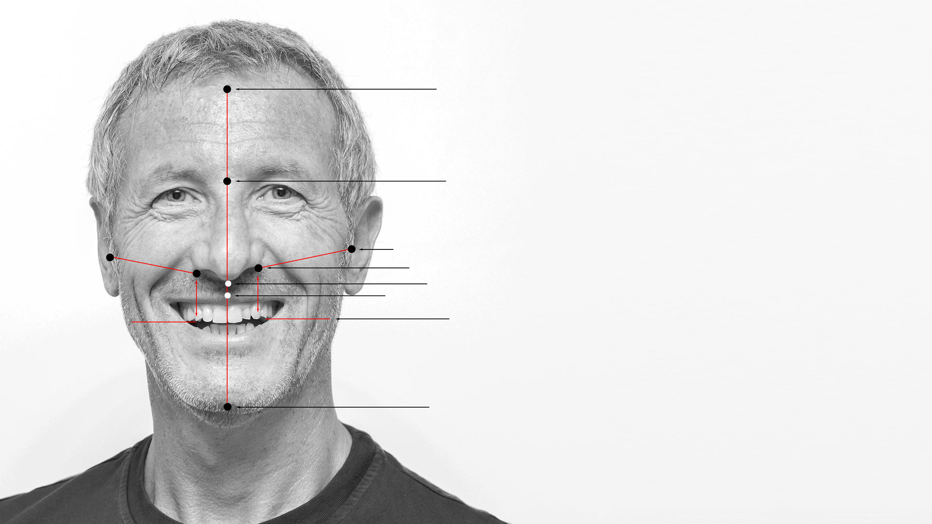 Frontale prothetische Orientierungspunkte im Gesicht eines Mannes