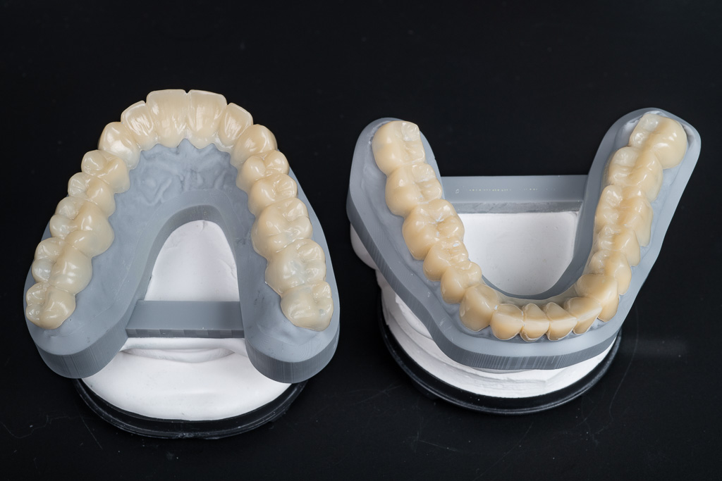 Ok und UK Schienen auf dem Modell - Draufsicht