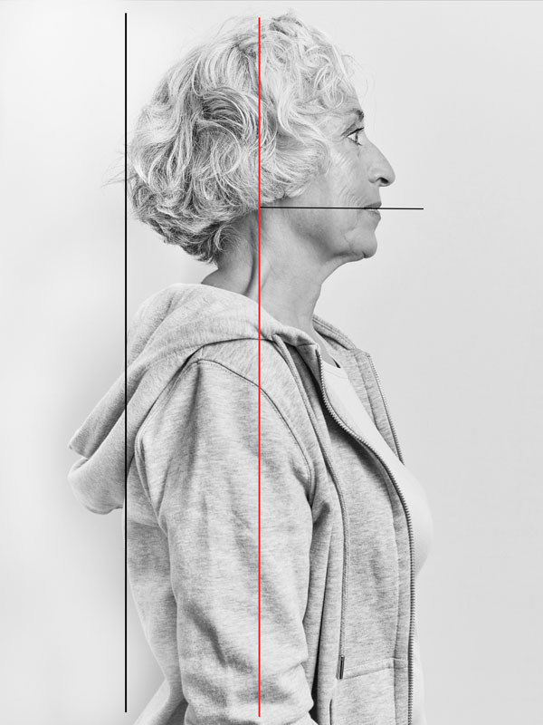 Foto einer neutralen Gebisssituation