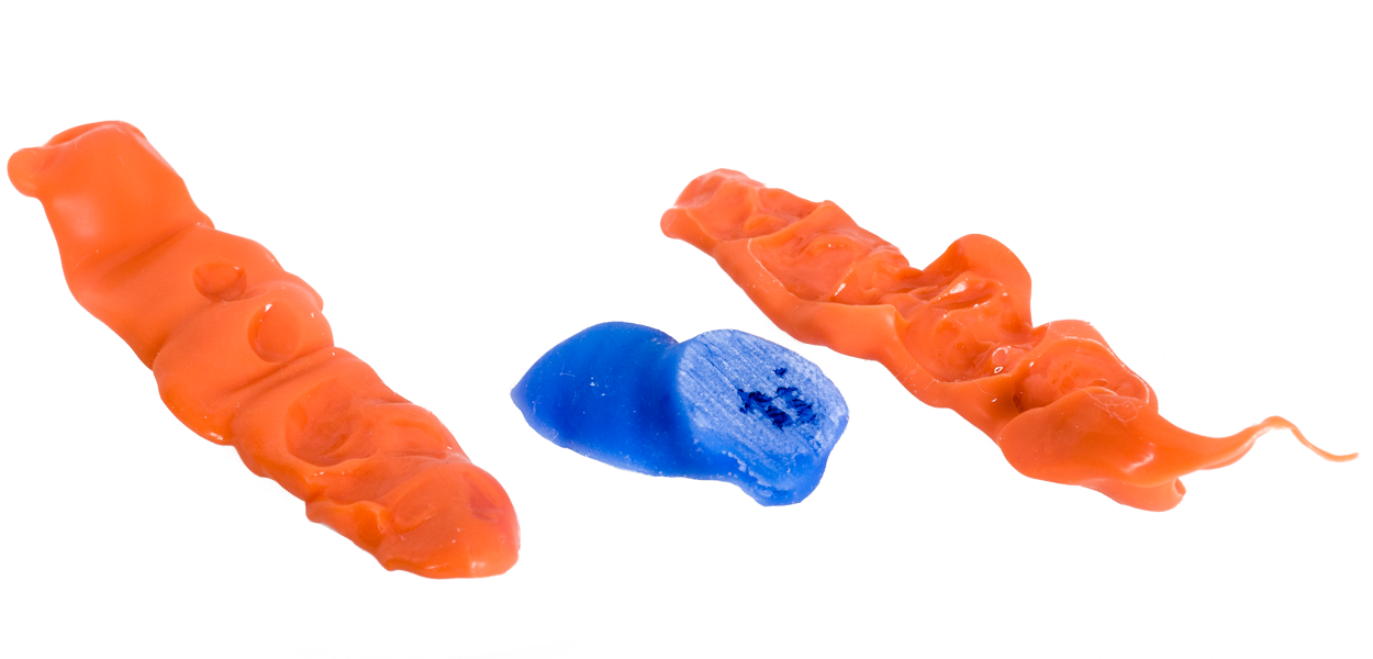 Zentrisches Bissregistrat