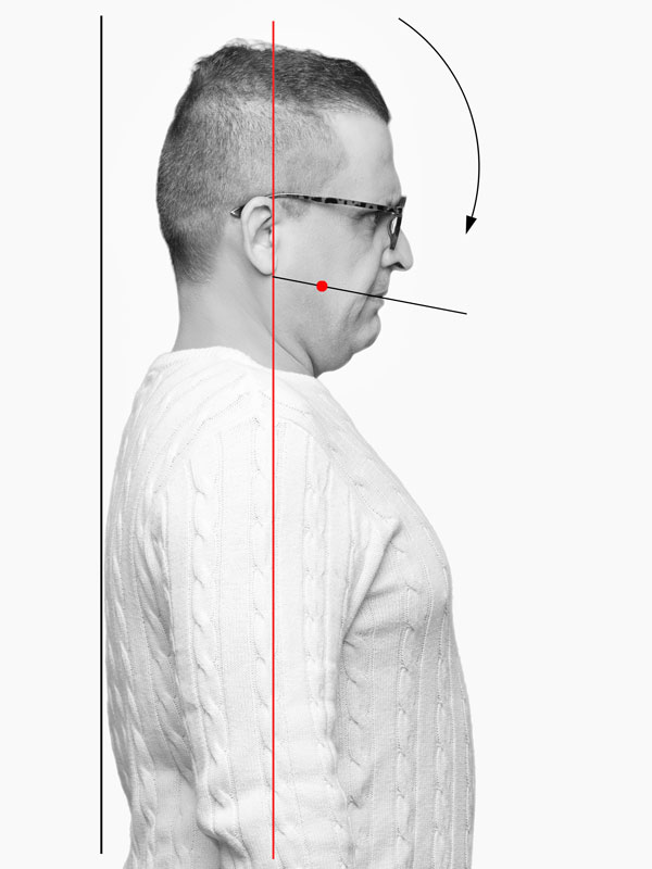 Foto einer Seitenzahn Gebisssituation