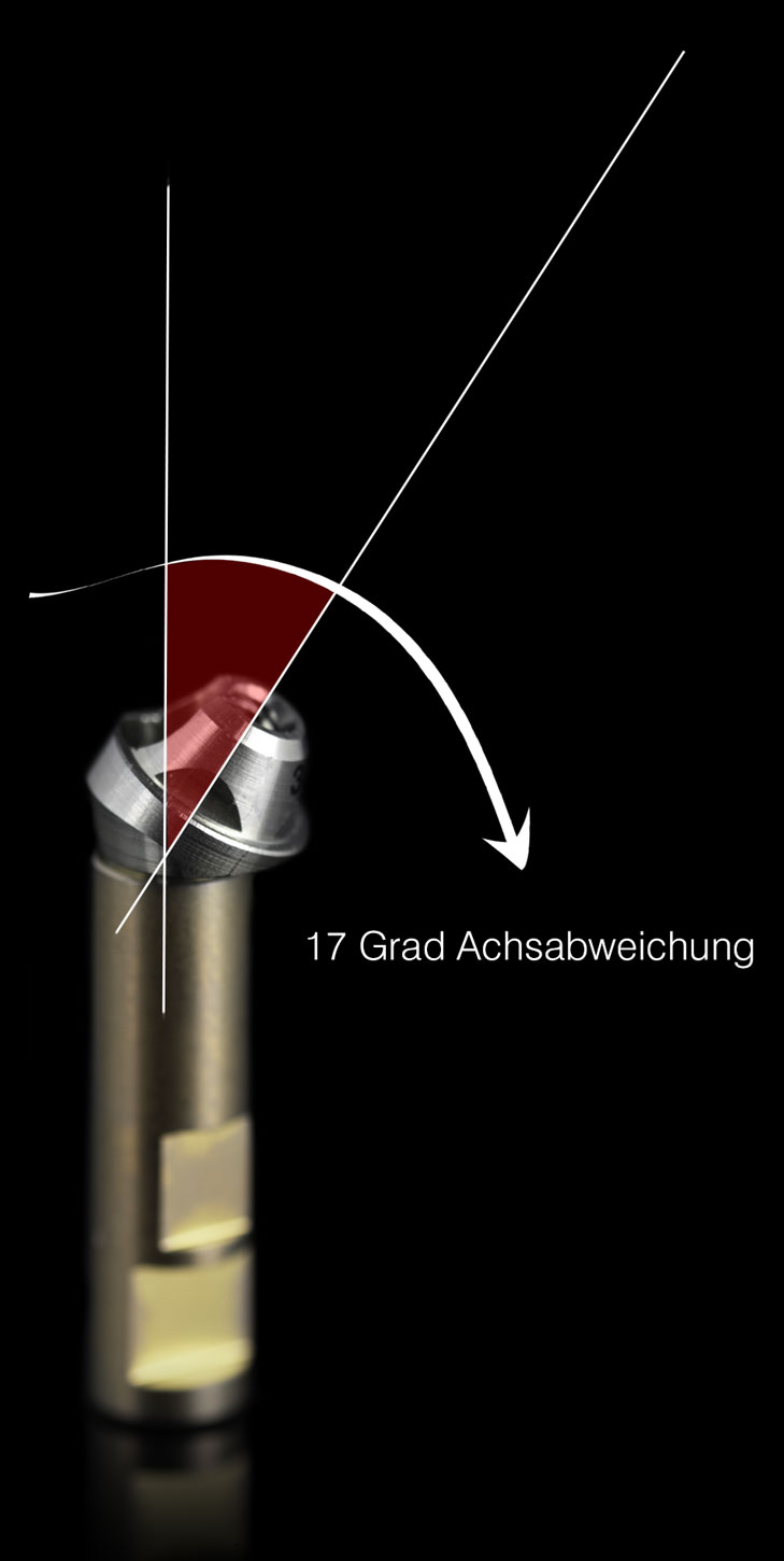 abgewinkeltes Implantatabutment 17 Grad