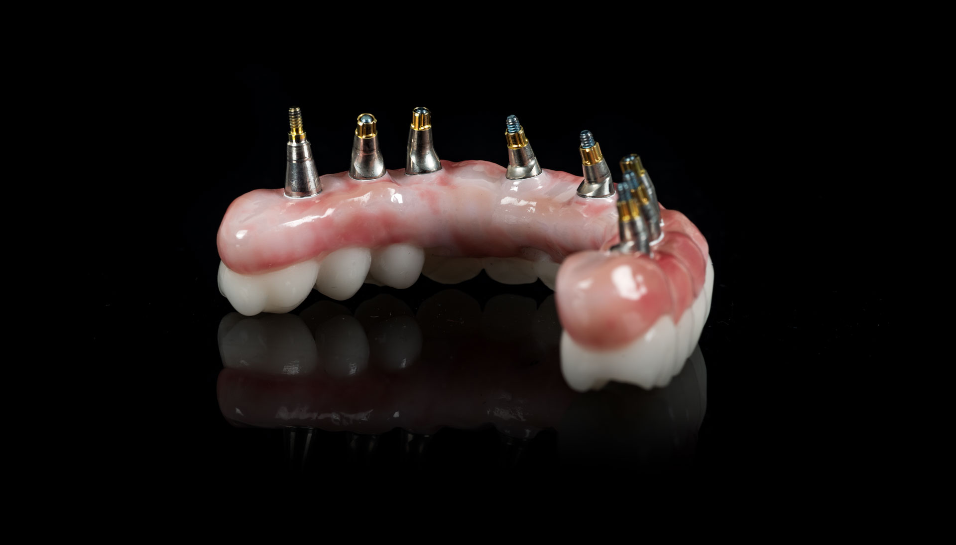 Basis einer bedingt abnehmbaren Implantatprothes