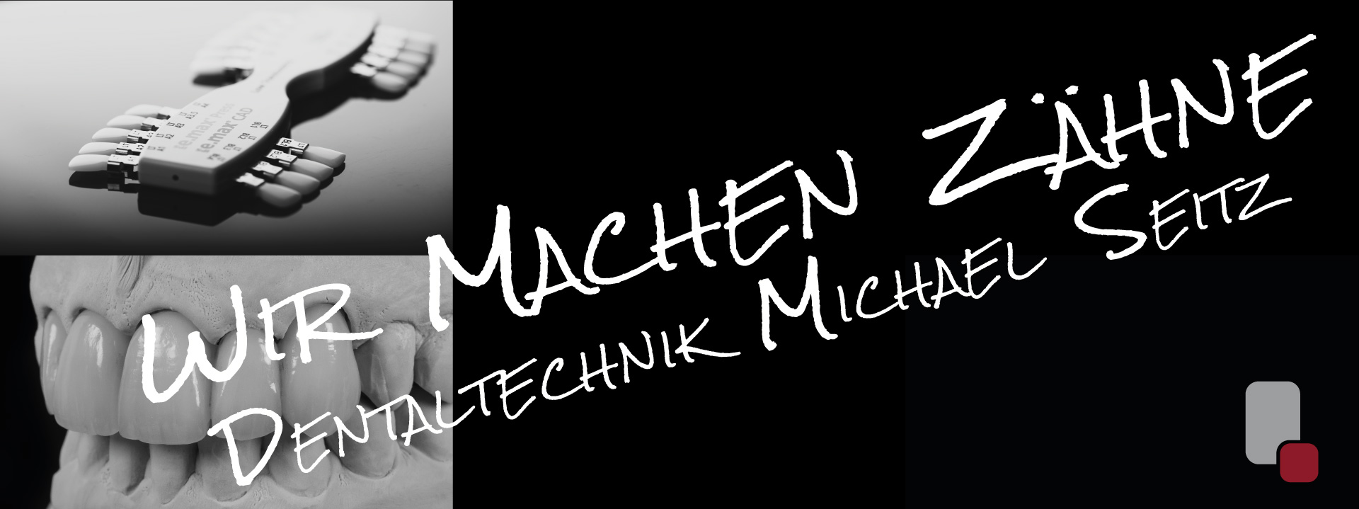 Oberkiefer Frontzähne und Farbschlüssel